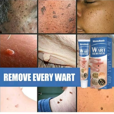 HỘP KEM BÔI TRỊ HẾT MỤN CÓC MỤN THỊT NÚT RUỒI DA THÂM SẠM 