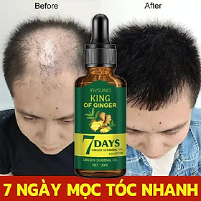 Tinh Dầu Xịt Mọc Tóc EELHOE: Tinh Chất Nhân Sâm và Gừng Tươi Thiên Nhiên Kích Thích Mọc Tóc Sau 7 Ngày Loại Tốt