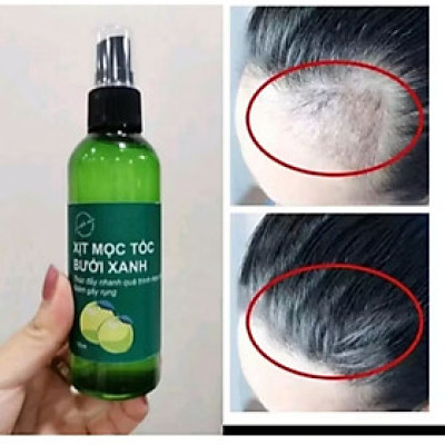 CHAI TINH DẦU BƯỞI THẢO MỘC XỊT KÍCH THÍCH MỘC TÓC CAO CẤP CHO MỌI NGƯỜI