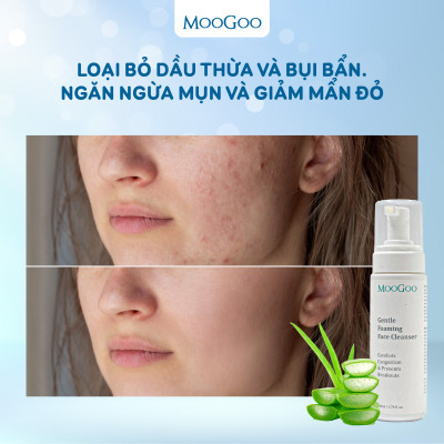 Sữa rửa mặt tạo bọt dưỡng ẩm chiết xuất đu đủ cho da nhạy cảm, da mụn ko SLS, Sulffate Moogoo thuần chay thiên nhiên Úc
