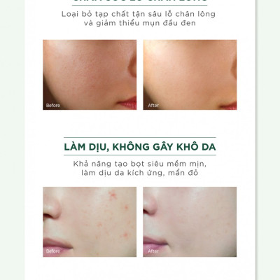 Sữa rửa mặt Caryophy Portulaca Cleansing Foam 3 In 1