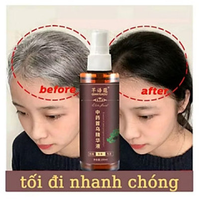 CHAI TINH DẦU THẢO MỘC XỊT LÀM ĐEN TÓC TÓC TRẮNG THÀNH TÓC ĐEN ĐẸP CHẤT LƯỢNG