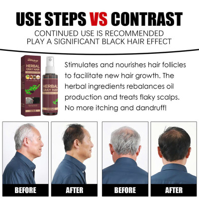 Tinh Chất Dầu Dưỡng Thảo Dược Xịt Đen Tóc Vĩnh Viễn – Giải Pháp Phục Hồi Tóc Bạc Tại Nhà Hiệu Quả