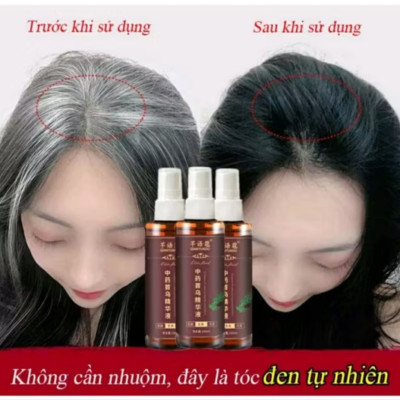 CHAI TINH DẦU THẢO MỘC XỊT LÀM ĐEN TÓC TÓC TRẮNG THÀNH TÓC ĐEN ĐẸP CHẤT LƯỢNG