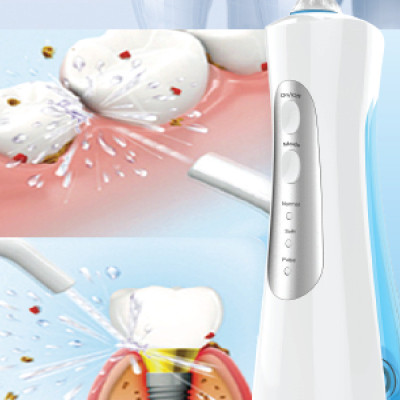 Máy tăm nước MAXVI 4 vòi dùng cho cả gia đình và người chỉnh nha, người bọc răng sứ, làm sạch kẽ, cao răng - Hàng nhập khẩu - có cục sạc nhanh 2A chuẩn cho máy