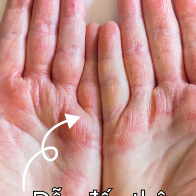 Xả Kho Găng Tay Cao Su Tự Nhiên Hàn Quốc Thương Hiệu BEIGL Đủ Kích Cỡ