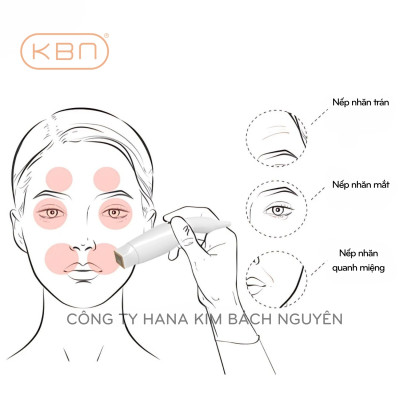 Máy Nâng Cơ POLKA RF Hàn Quốc Xóa Nhăn, Trẻ Hóa Da