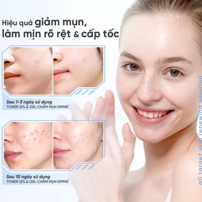 Dung dịch tẩy tế bào chết và tái tạo da Emmié All Target Skin Renewing Solution Pionin + 12% AHA/BHA/PHA (120ml) - Hàng chính hãng