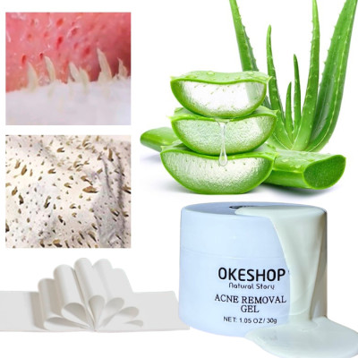 Gel Lột Mụn OKESHOP 30ml - Giải Pháp Loại Bỏ Mụn Đầu Đen - Mụn Cám - Bạ Nhờn - Làm Sạch Sâu Và Thu Nhỏ Lỗ Chân Lông