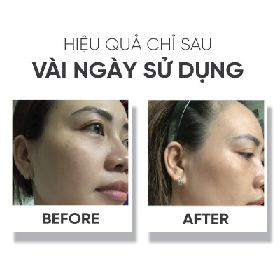 Kem dưỡng đêm,dưỡng ẩm,dưỡng trắng da LÁ HOUSE Astalock Night Cream 10ml/30ml