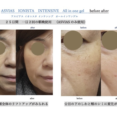 Dưỡng ẩm chống lão hóa 5 trong in ASVIAS IONISTA INTENSIVE