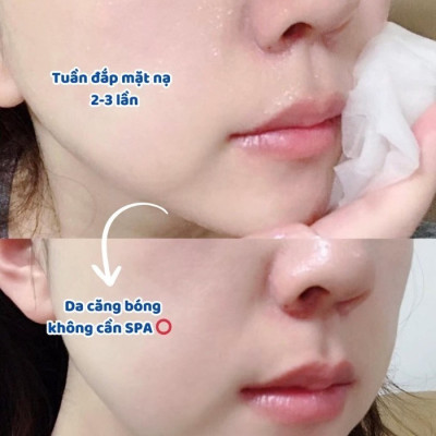Mặt Nạ Phục Hồi Tế Bào Gốc SenaDemar Sodium DNA B5 Mask 25ml