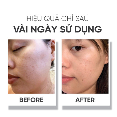 Tinh chất dưỡng trắng da Lá House Astalock Concentrated Essence 15ml/30ml