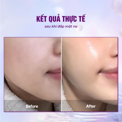 [Set Vàng Rực Rỡ] Set 4 Mặt nạ BESKINATY hỗ trợ phục hồi dưỡng da chuyên sâu