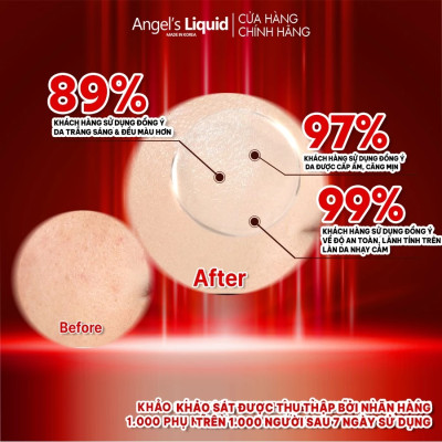 Kem Dưỡng Trắng Da Cấp Ẩm Đa Tầng Angel