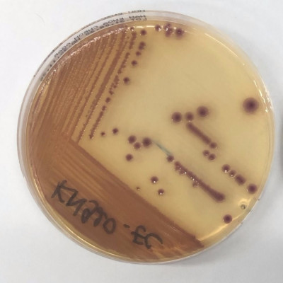 Đĩa Chromoagar Sàng Lọc Các Vi Khuẩn Đường Ruột Kháng Kháng Sinh Carbapenem