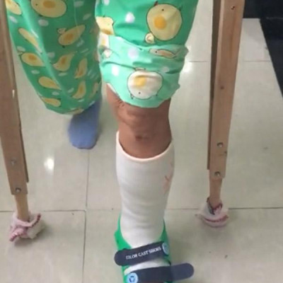 Giày bảo vệ chân BL Tech size M (Xanh lá cây) dùng cho chân đang chấn thương hoặc bó bột