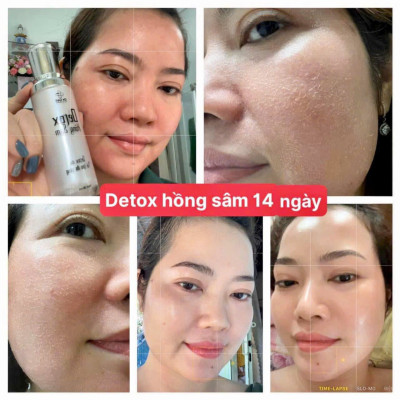 Detox Hồng Sâm Dr Cell 50ml thải độc tố da hỗ trợ giảm mụn hỗ trợ mờ thâm nám - Hàng Chính Hãng