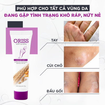 Kem nứt gót Oriss dưỡng ẩm làm mềm gót chân làm liền vết thương 30g