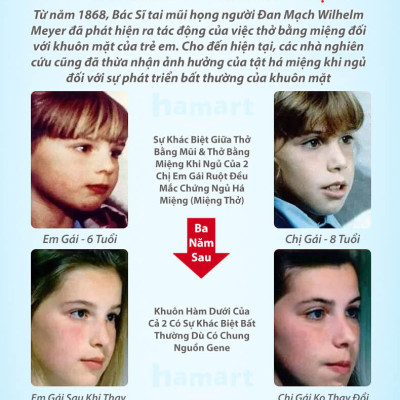 Gói 30 Miếng Dán Chống Há Miệng Khi Ngủ Giảm Ngáy Mouth Seal Băng Dính Miệng Người Lớn Trẻ Em