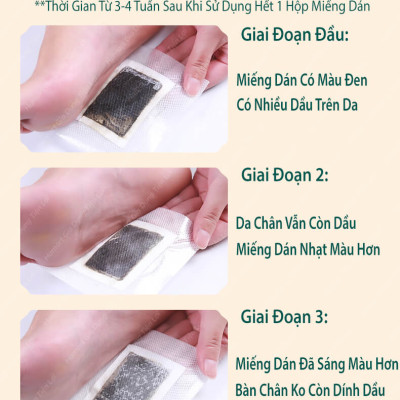 Hộp 50 Miếng Dán Thải Độc Chân Lao Beijing Thải Độc Ngải Cứu Ngủ Ngon Thư Giãn Chân Hiệu Quả