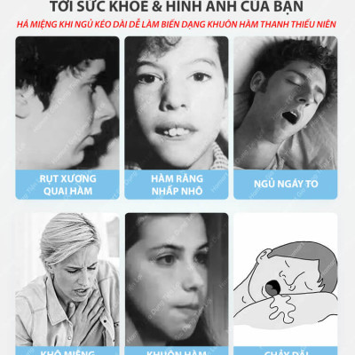 Gói 30 Miếng Dán Chống Há Miệng Khi Ngủ Giảm Ngáy Mouth Seal Băng Dính Miệng Người Lớn Trẻ Em