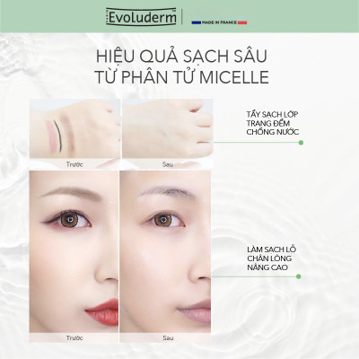 Nước tẩy trang Evoluderm Micellar Cleansing Water 250ml
