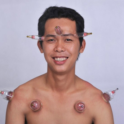Bộ Giác Hơi Không Dùng Lửa Duy Thành YGH01