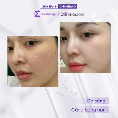 Combo Kem Dưỡng Trắng, Căng Bóng Da, Chống Lão Hoá The Gentinol 0221
